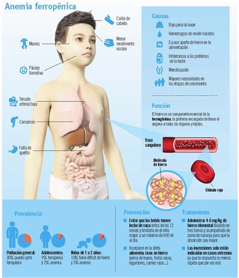 Ferropenia, principal causa de anemia en niños   Canal ...