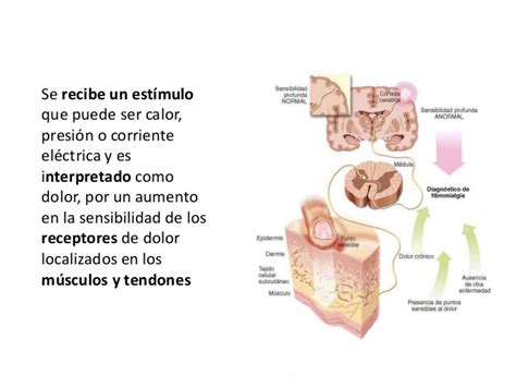 Fibromialgia AFIBRODON