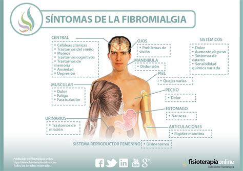 Fibromialgia. Causas, sintomas, diagnóstico y tratamiento ...
