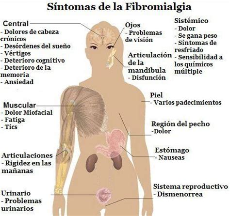 Fibromialgia | Fibromialgia | Pinterest | Fibromialgia ...