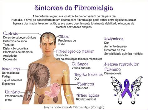 Fibromialgia: Mitos e verdades   Clínica Dr. Hong Jin Pai ...