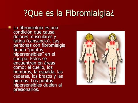 Fibromialgia