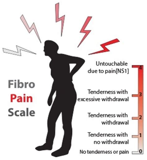 Fibromyalgia Treatment | Arizona Pain Specialists ...