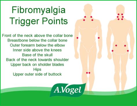 Fibromyalgia Trigger Points