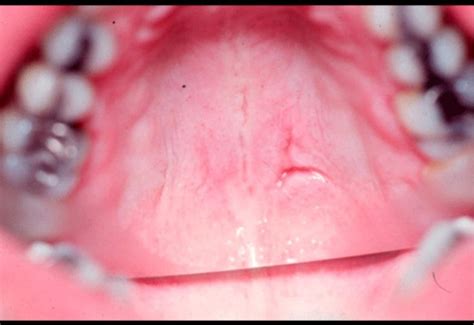 Flashcards   Oral Pathology   | StudyBlue