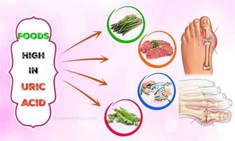 Foods With Uric Acid | Food