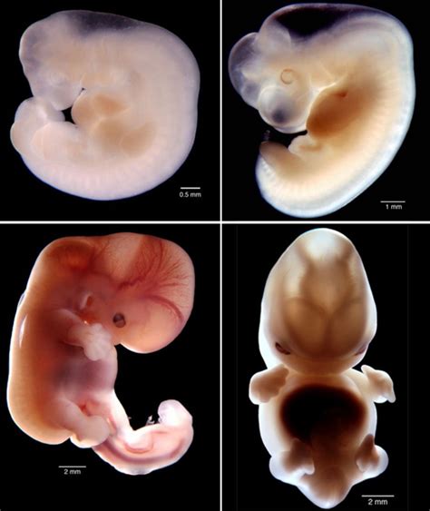 Fotografías del feto semana a semana durante el embarazo