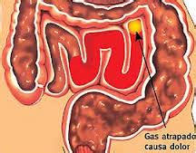 Gases intestinales y estomacales: Causas, síntomas y ...