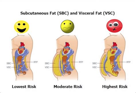 Grasa abdominal: por qué se acumula, cómo evitarla y cómo ...