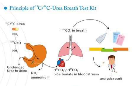 H Pylori Urea Breath Test Kit For 13c Urea Breath Test ...