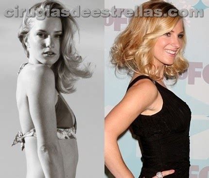Heather Morris antes y después Cirugías de estrellas
