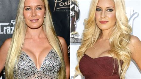 Heidi Montag and Other Celebrities Opting for Breast ...