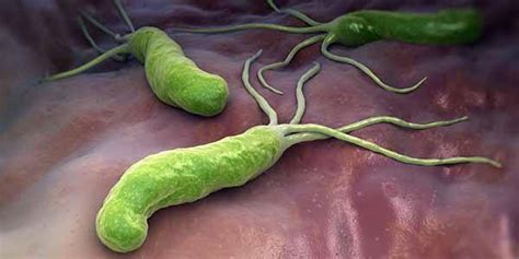 Helicobacter pylori: cause, contagio, sintomi e dieta da ...