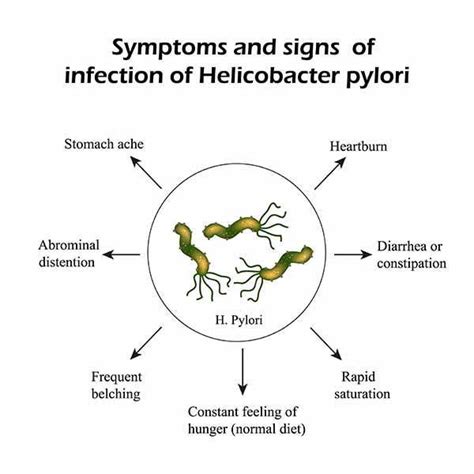 Helicobacter pylori: cause, contagio, sintomi e dieta da ...