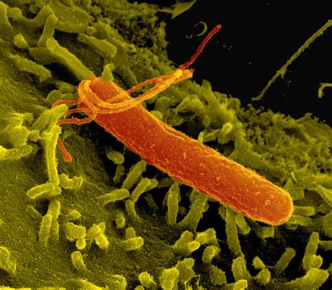 Helicobacter pylori infection leaves a fingerprint in ...
