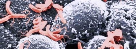 Helicobacter Pylori: la bacteria que más contagia a la ...