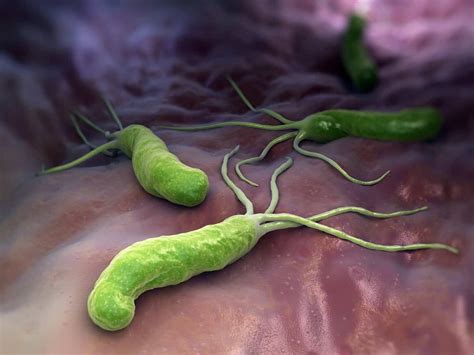 Helicobacter pylori   Natural Treatments and The Best Way ...