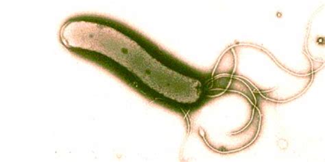 Helicobacter Pylori, Qué es, Cuáles son sus Síntomas, Cómo ...