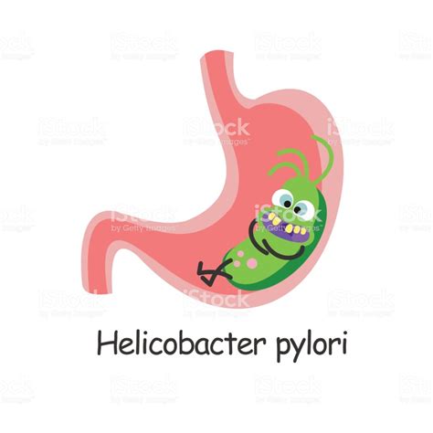 Helicobacter Pylori Schädliche Bakterien Im Magen Zu ...