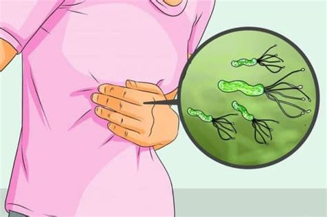 Helicobacter pylori sintomi e cura in adulti e bambini ...