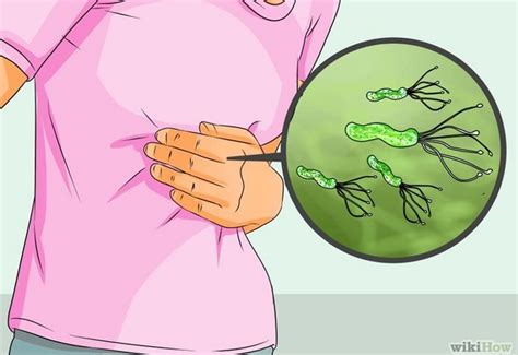 Helicobacter pylori, sintomi e cura