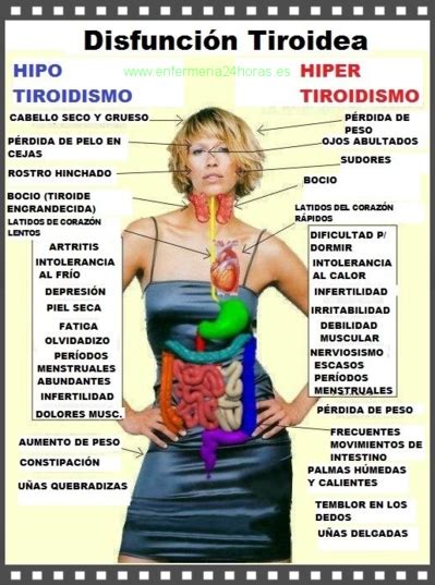 hipertiroidismo, hipotiroidismo | tiroides | Pinterest ...