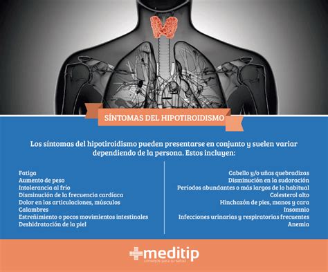 Hipotiroidismo: causas, diagnóstico y tratamiento   Meditip