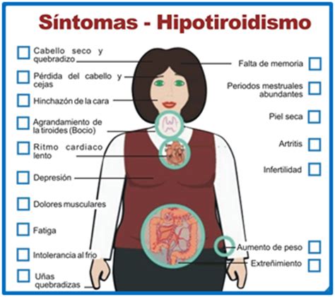 Hipotiroidismo e Hipertiroidismo   Teatro Blog   Cine Blog ...