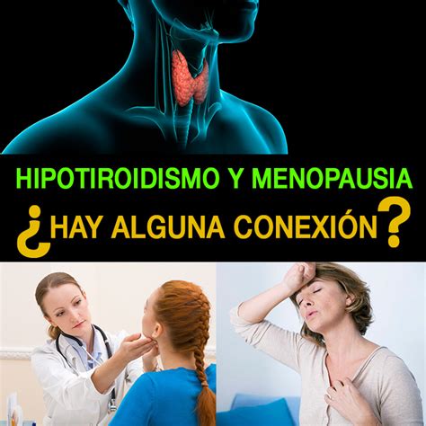 Hipotiroidismo Y Menopausia ¿Hay Alguna Conexión?   La ...