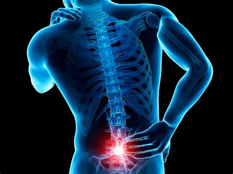 Hombres, los más afectados por dolor en espalda baja