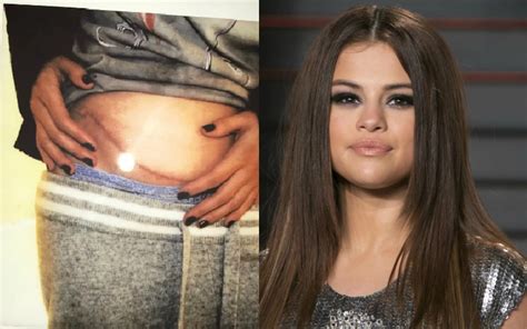 How Selena Gomez lupus led her to kidney transplant NAIJ.COM