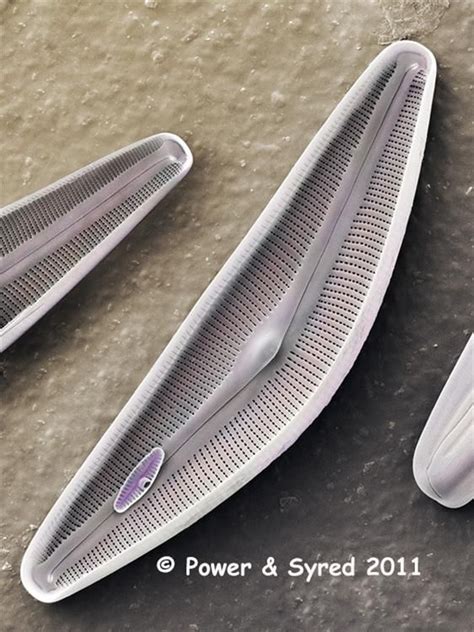 http://www.psmicrographs.co.uk/diatom frustules  sem ...
