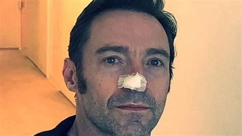 Hugh Jackman, operado de cáncer de piel