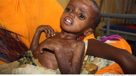 Hunger afflicts 1 in 9 worldwide   Sep. 15, 2014