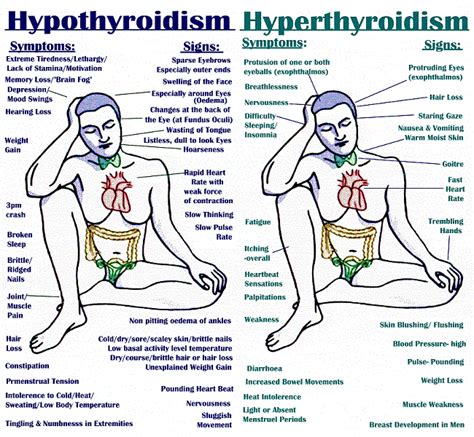 Hypothyroidism And Hyperthyroidism Symptoms, Signs, Causes ...