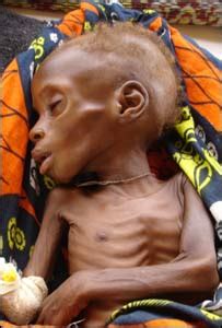 IAR Noticias/ 40 niños al día mueren por hambre en Niger ...