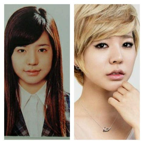 Idols, antes y después de la cirugía plástica. | •K Pop• Amino