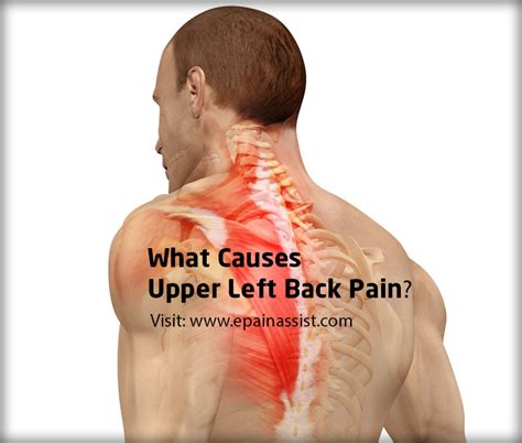 Image Gallery lung symptoms back pain