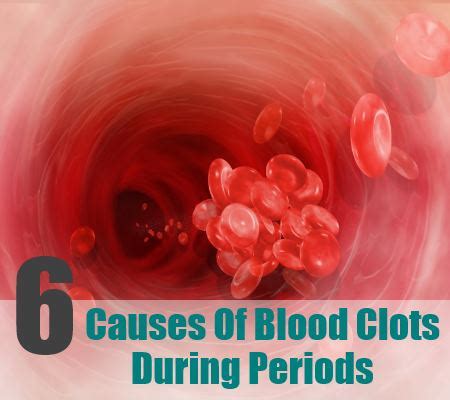 Image Gallery menstrual clots