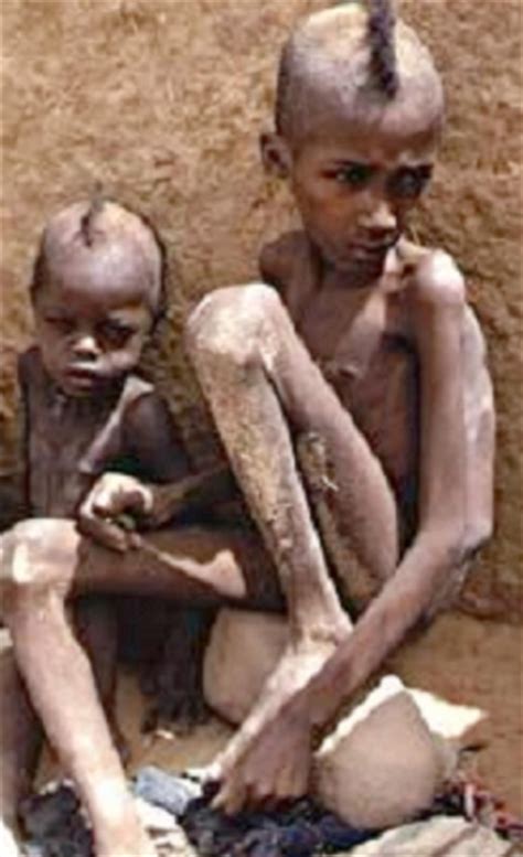 Imagen Niños desnutridos en Nigeria   grupos.emagister.com