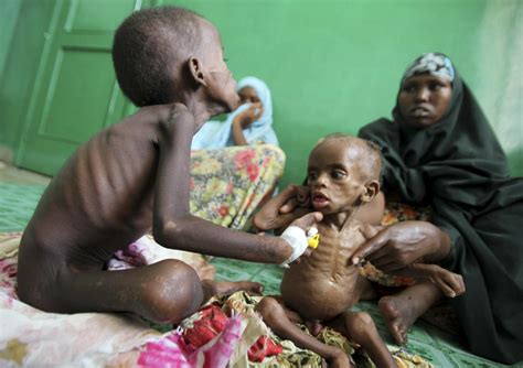 IMAGENES ETHEL: imagenes de niños africanos muriendo de hambre