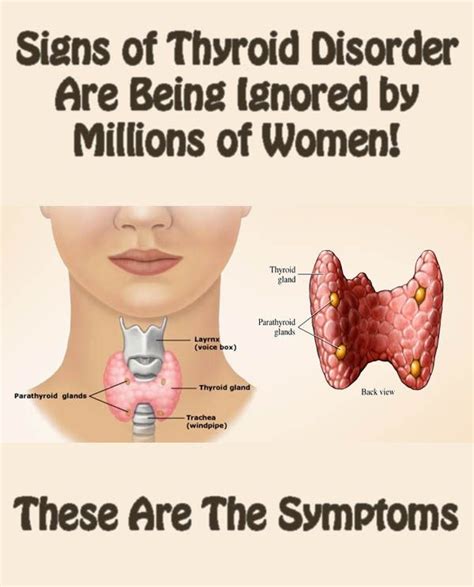 Important Symptoms Of Thyroid Problems For Women ...