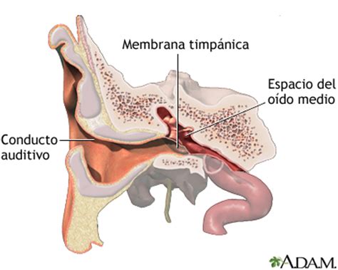 Infección crónica del oído