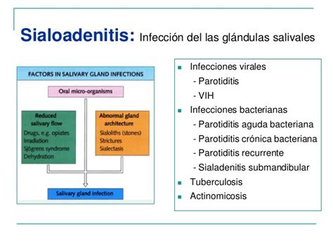 infecciones de las glándulas salivares