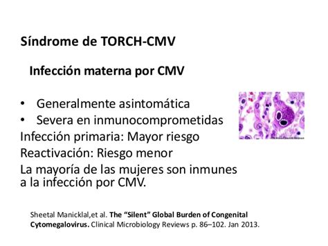 Infecciones virales en el embarazo. Dra. Ana Carvajal