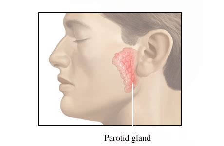 Infection In My Salivary Gland – Lymphnodetoad