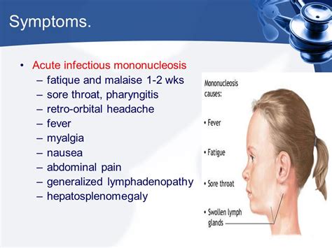 Infectious Mononucleosis.   ppt video online download