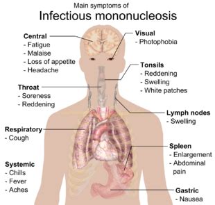 Infectious mononucleosis   Wikipedia