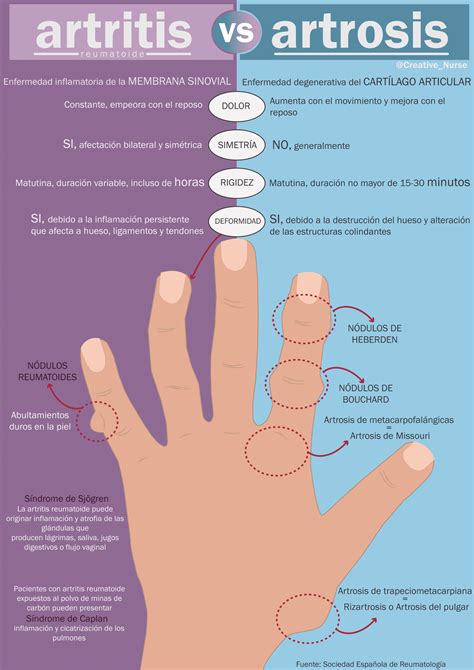 Infografías   Página web de creativenurse artritis vs ...