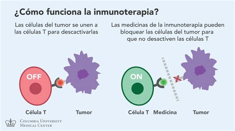 Inmunoterapia: Nueva esperanza para pacientes con Cáncer ...